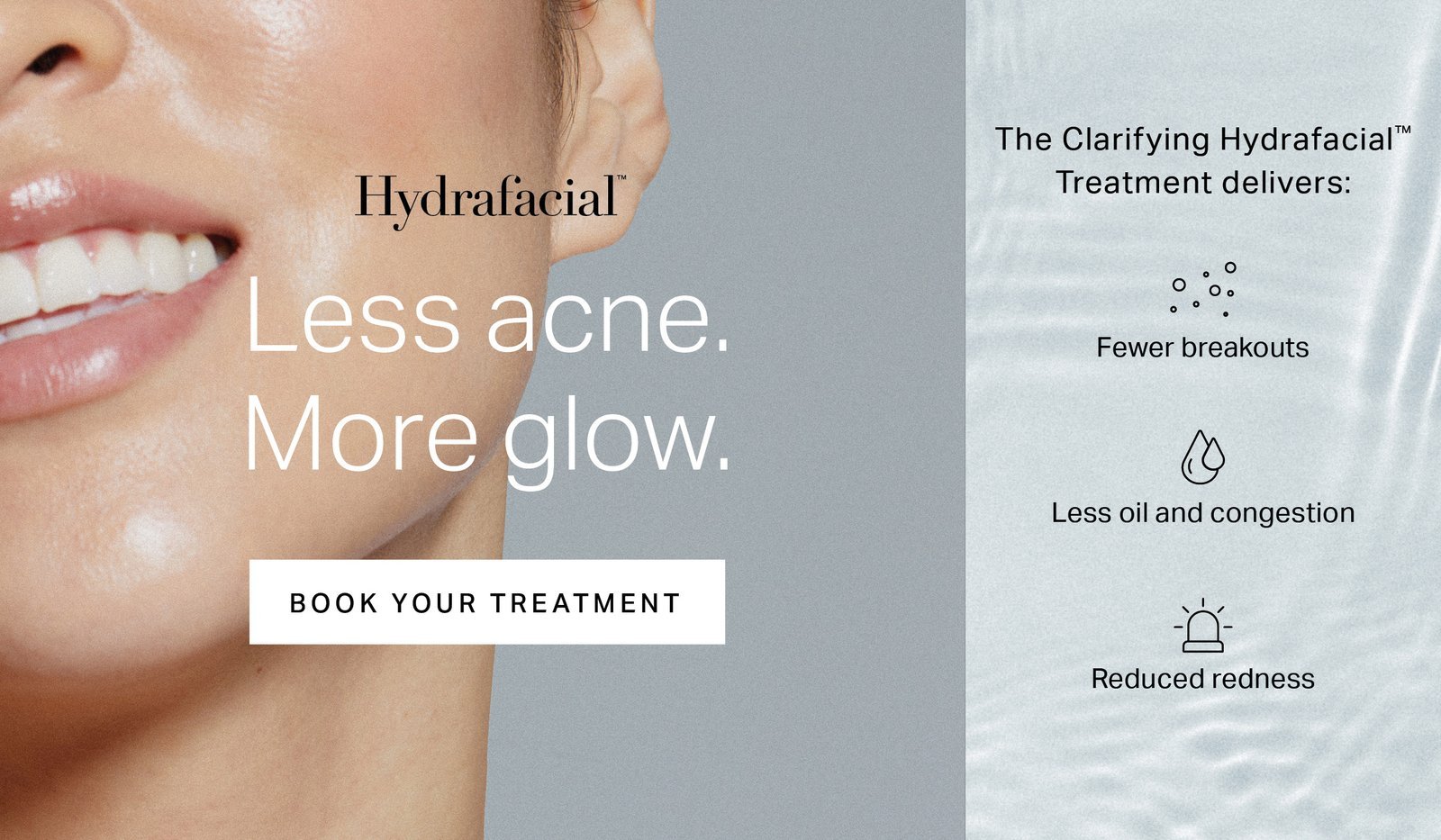 HydraFacial treatment at Drip’n Wax & Spa, Perry Hall Maryland